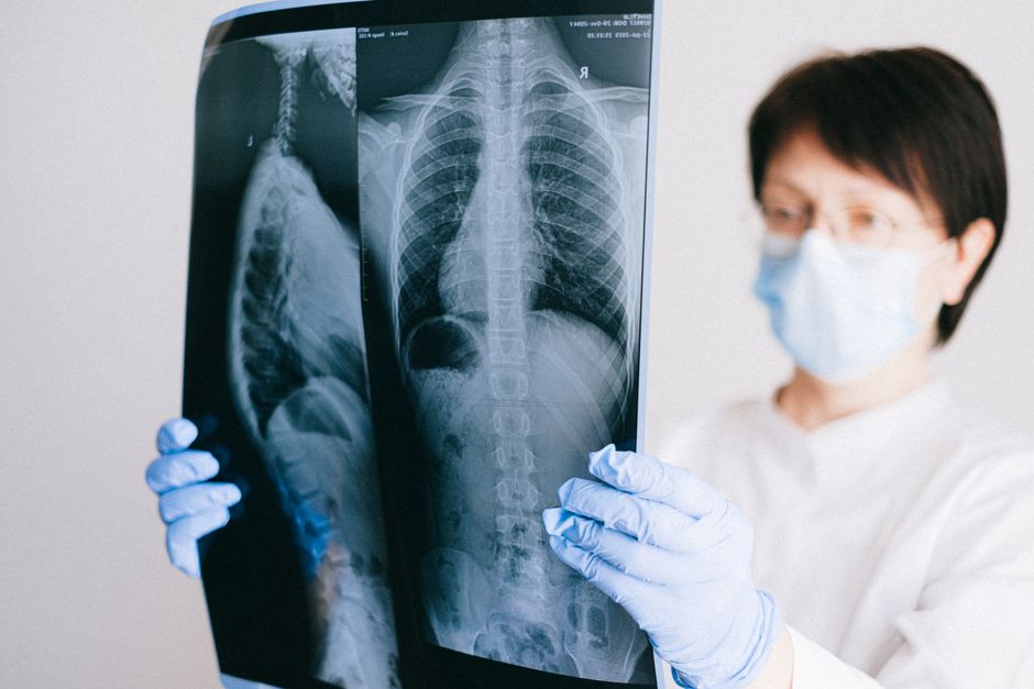A medical professional analyzes a chest x-ray wearing gloves and a mask in a clinical setting.