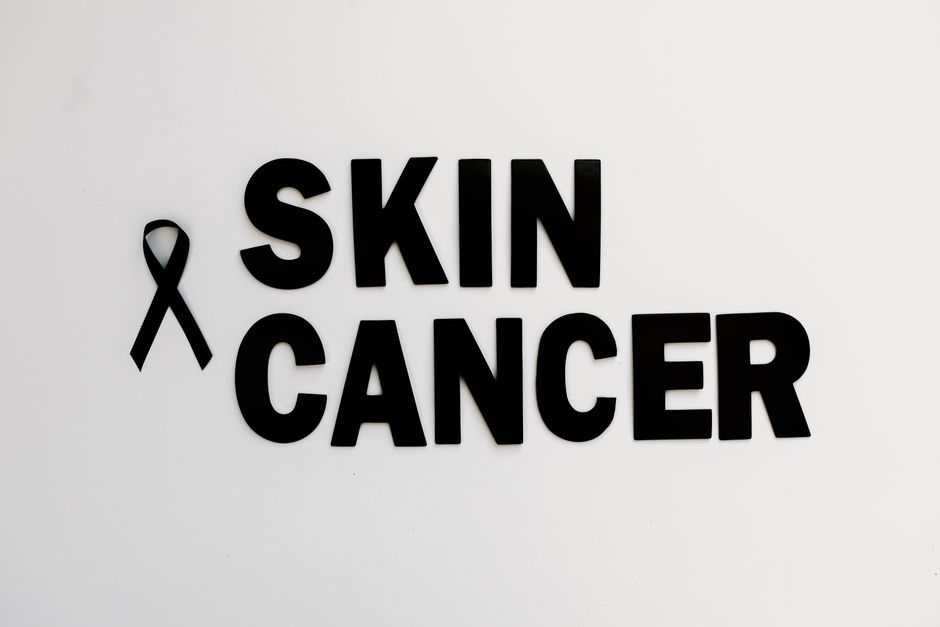 Conceptual image of skin cancer awareness with black ribbon on white background.