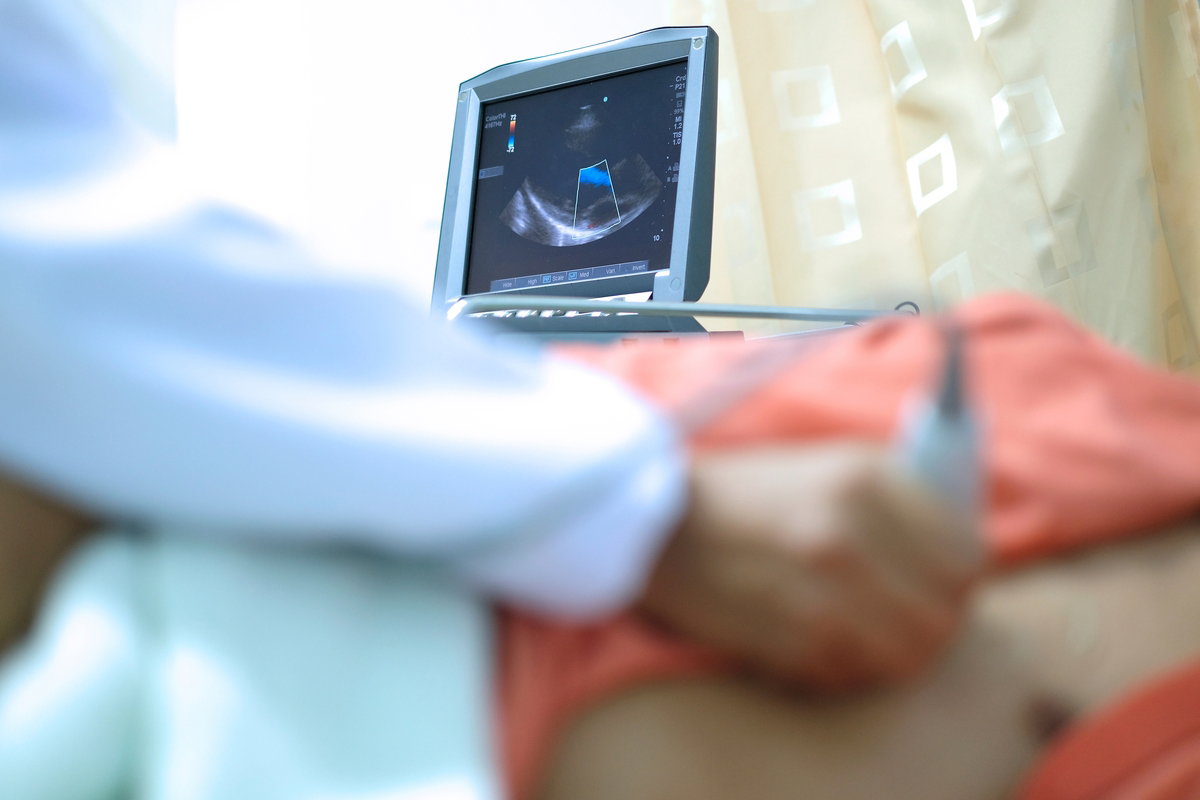 Ecocardiograma: entenda como funciona este exame cardíaco por ultrassom