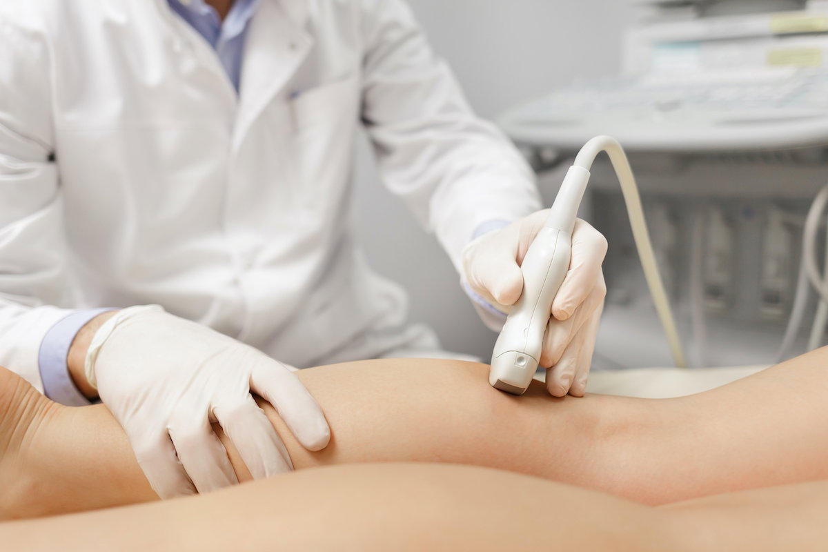 Flebite: inflamação venosa, sintomas e quando procurar um médico