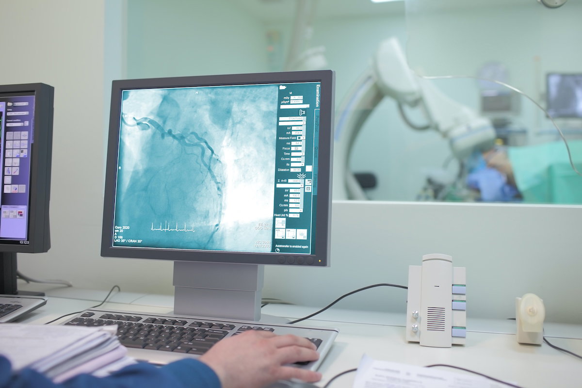 Angiotomografia: exame de vasos sanguíneos e diagnóstico vascular