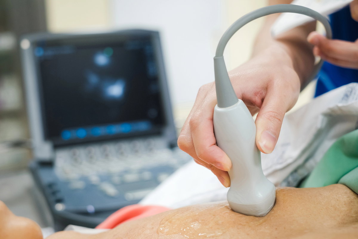 Ecodopplercardiograma: tipos e quando é solicitado